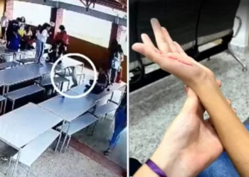 Pitbull invade escola e ataca alunos; 3 crianças ficam feridas
